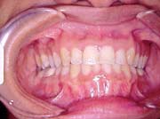 Ortodontia depois